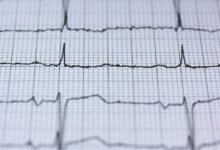 apex fusion beam technology